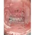2.5 " Dia Schenck Process Feeder